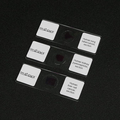 Prepared Human Pathology Microscope Slide Set, 12pcs Research-Quality Prepared Tissue Microscope Slides of Human Diseases (Human Pathology)